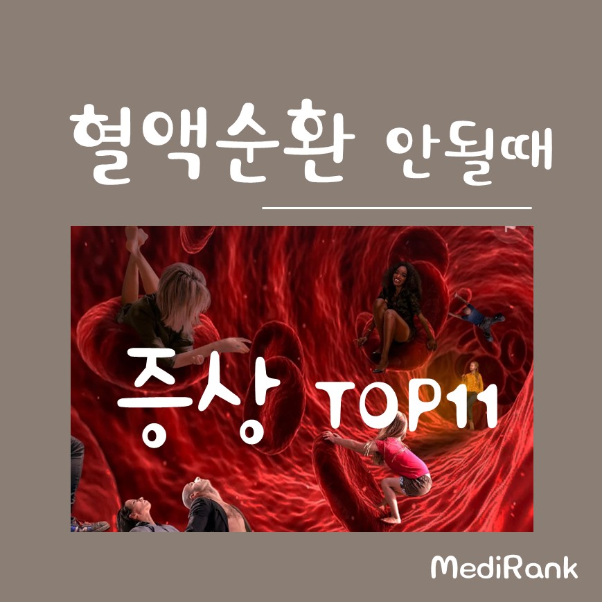 혈액순환 안될때 위험도 순 증상에 대한 썸네일 이미지