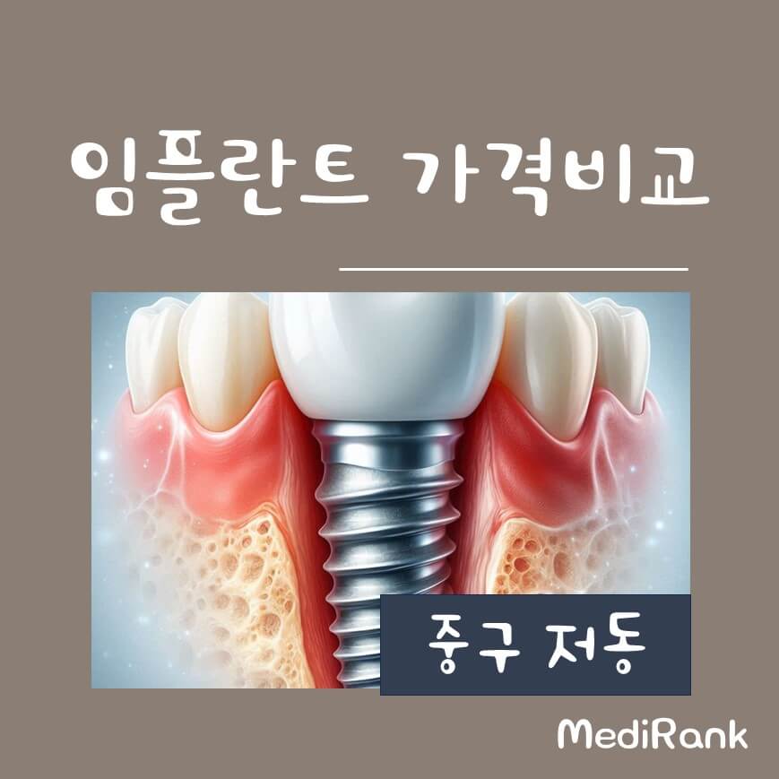 서울 중구 저동의 치과 임플란트 가격비교를 보여주는 썸네일 이미지